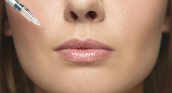 Le 10 migliori cliniche di filler per le labbra a Milano