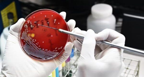 I-10-migliori-reparti-di-ematologia-a-Milano