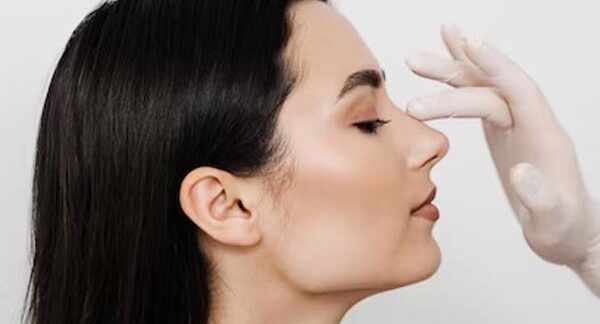 Le-10-migliori-cliniche-di-rinoplastia-a-Milano